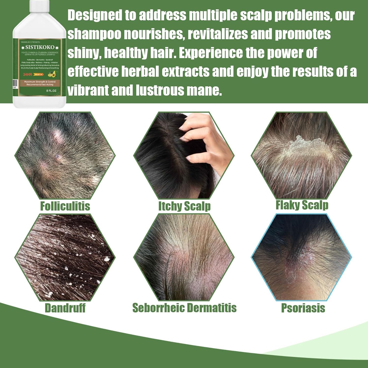 Anti Dandruff Shampoo N6695