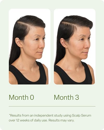 Hair Scalp Serum, 100ml R69690